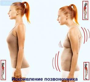 KRAFT_MASSAGE- 7 методик коррекции остерхондрозов