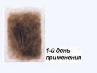 Пластырь «Сокровища Деревьев»