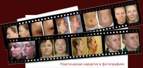 Клиника пластической хирургии «Dr. Shihirman»