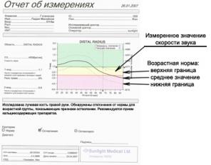 Ультразвуковой остеоденситометр Omnisense 7000