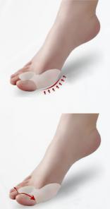 Фиксатор Valgus Pro