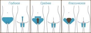 Как быстро избавиться от нежелательных волос?