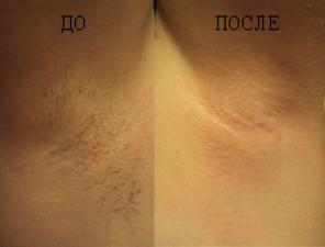Депиляция Шугаринг Воск Наращивание ресниц Шеллак