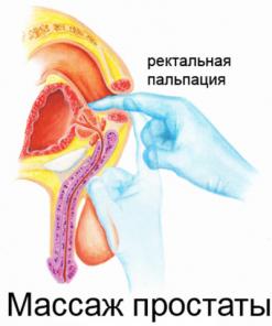 Урологический массаж на юго-западной