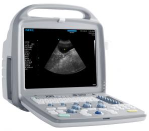 Продам УЗИ Аппарат (Сканер) SIUI CTS-7700