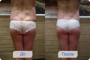 Коррекция фигуры