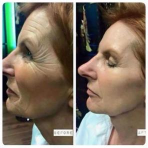 Крем Instantly Ageless