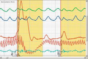 �������� �� ��������� ���